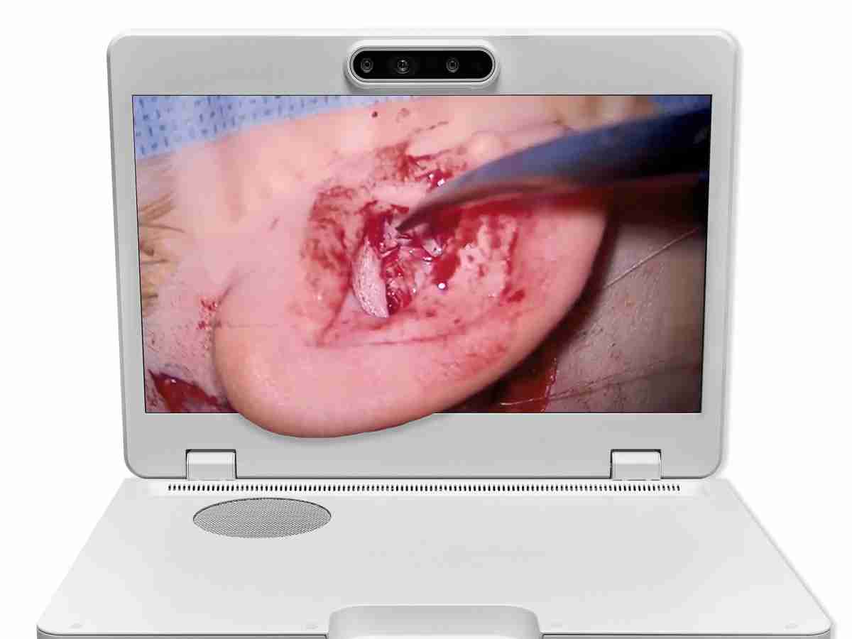 达擎之＂Heads-up 3D显微手术显示系统＂，，整合4K裸眼3D显示及眼球追踪系统，，，，具备快速追踪人眼移动位置功能，，，，减轻医师长时间维持固定姿势的负担，，，让医师能有更宽广清晰的3D立体视野及更舒适的姿势来执行手术。。